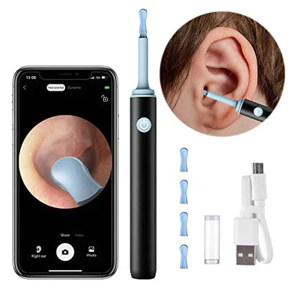 KRIAV™   - PROFESSIONAL EAR WAX REMOVAL TOOL